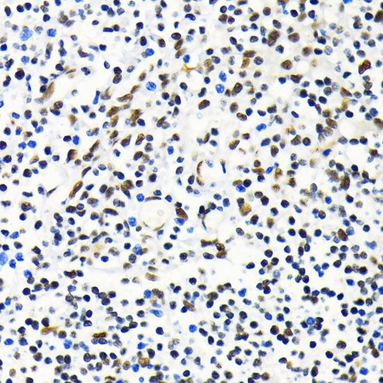 Anti-MKL1 Polyclonal Antibody (CAB8504)