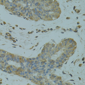 Anti-DGKQ Antibody (CAB3825)