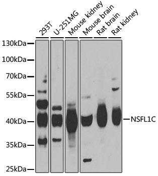 Anti-NSFL1C Antibody (CAB6677)