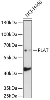 Anti-PLAT Antibody (CAB5655)