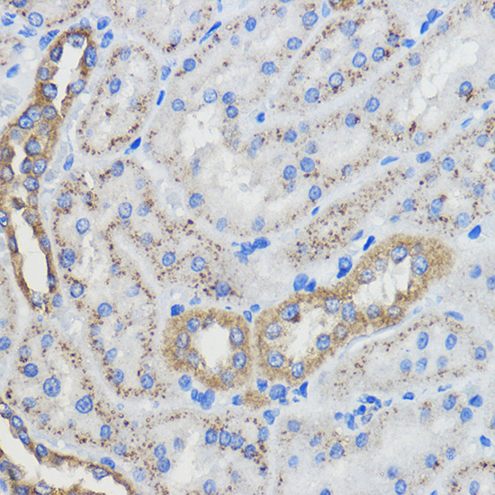 Anti-CYP51A1 Antibody (CAB13485)