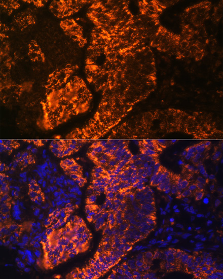 Anti-TNFRSF25 Antibody (CAB14261)