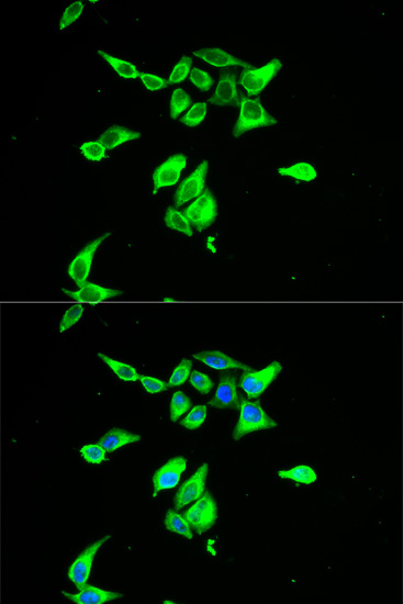 Anti-CD55 Antibody (CAB1228)