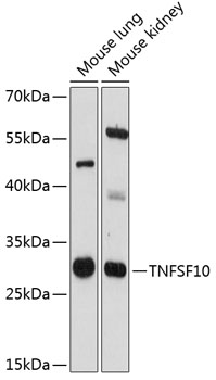 Anti-TNFSF10 Antibody (CAB12064)