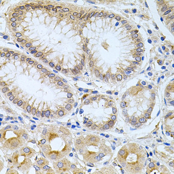 Anti-CPM Antibody (CAB6565)