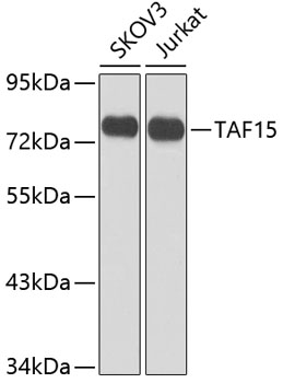 Anti-TAF15 Polyclonal Antibody (CAB8465)