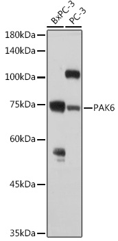 Anti-PAK6 Antibody (CAB7821)