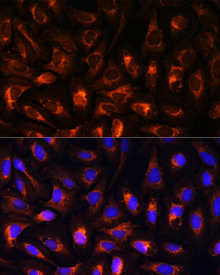 Anti-CART Antibody (CAB5395)