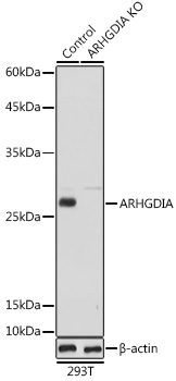 Anti-ARHGDIA Antibody [KO Validated] (CAB1214)