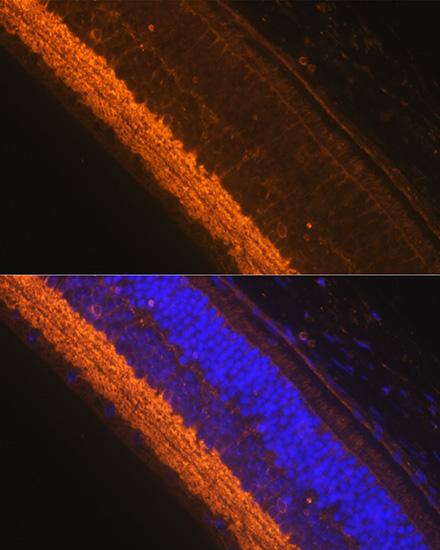 Anti-GAD1 Antibody (CAB2938)