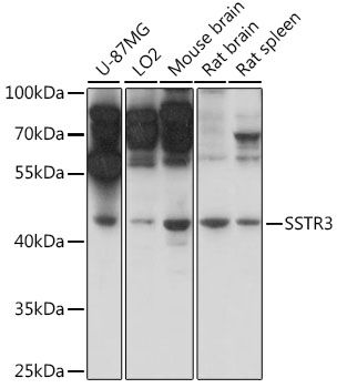 Anti-SSTR3 Antibody (CAB16071)