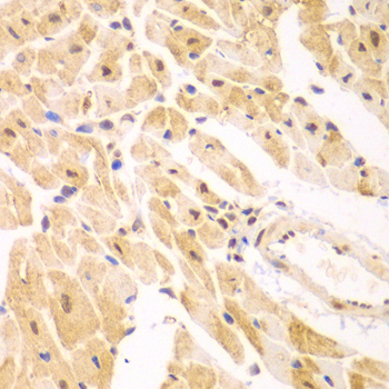 Anti-PSMD2 Antibody (CAB1999)