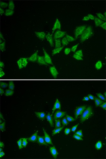 Anti-BNIP2 Antibody (CAB6282)