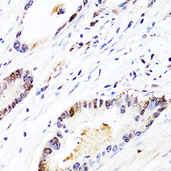 Anti-FGF12 Antibody (CAB2667)