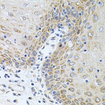 Anti-CPM Antibody (CAB6565)