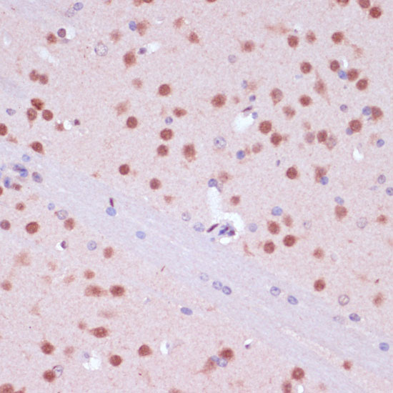 Anti-RBFOX3 Antibody (CAB15959)