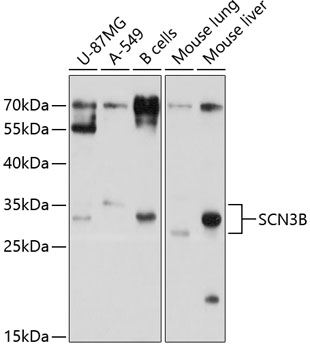 Anti-SCN3B Antibody (CAB10316)