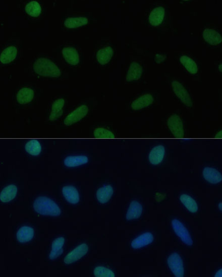 Anti-TRIM28 Antibody (CAB2245)