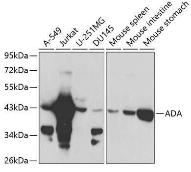 Anti-ADA Antibody (CAB1019)