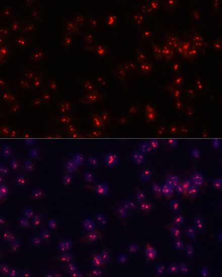 Anti-FBL Antibody (CAB13490)