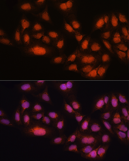 Anti-MAD2L2 Antibody (CAB12559)