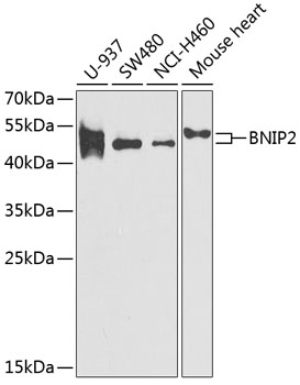 Anti-BNIP2 Antibody (CAB6282)