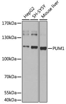 Anti-pum1 Antibody (CAB13389)