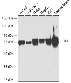 Anti-TFG Antibody (CAB7769)