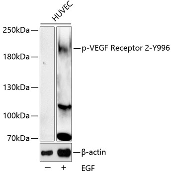 Anti-Phospho-VEGFR2-Y996 Antibody (CABP0595)