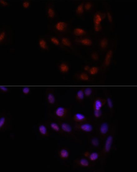 Anti-HOXA2 Polyclonal Antibody (CAB9658)