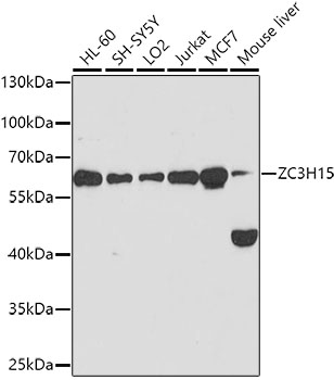 Anti-ZC3H15 Antibody (CAB10045)