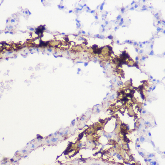 Anti-COL1A1 Antibody (CAB16891)