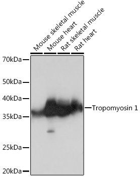 Anti-Tropomyosin 1 Antibody (CAB8723)