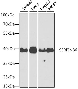 Anti-Serpin B6 Polyclonal Antibody (CAB9944)