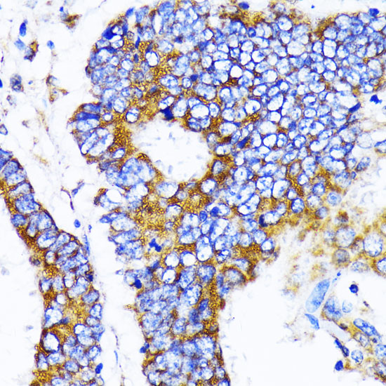 Anti-MRPL13 Antibody (CAB14122)