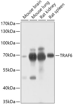 Anti-TRAF6 Antibody (CAB16991)