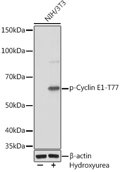 Anti-Phospho-Cyclin E1-T77 Antibody (CABP1014)