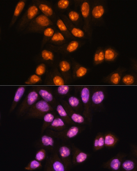 Anti-YY2 Antibody (CAB16621)