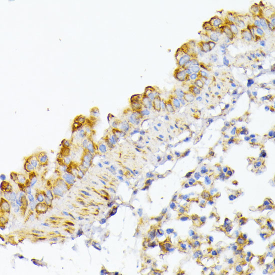 Anti-ATG7 Antibody (CAB0691)