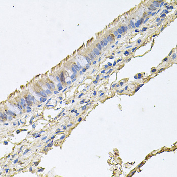 Anti-EPOR Antibody (CAB2917)