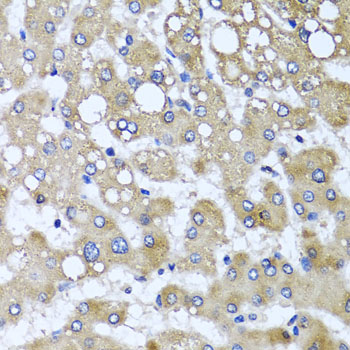 Anti-TTLL12 Polyclonal Antibody (CAB8197)