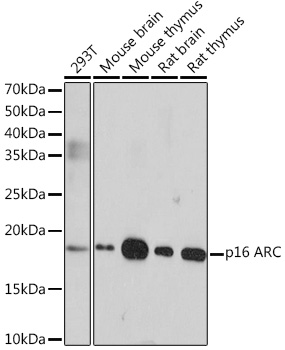 Anti-p16 ARC Antibody (CAB4794)