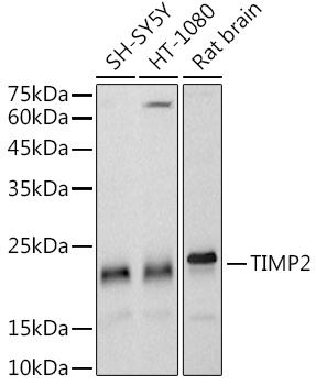 Western blot analysis of extracts of various cell lines, using TIMP2 antibody at 1:1000 dilution. Secondary antibody: HRP Goat Anti-Rabbit IgG (H+L) at 1:10000 dilution. Lysates/proteins: 25ug per lane. Blocking buffer: 3% nonfat dry milk in TBST. Detection: ECL Basic Kit. Exposure time: 20s.