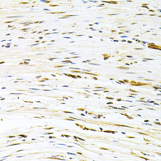 Anti-MDM2 Antibody (CAB0345)