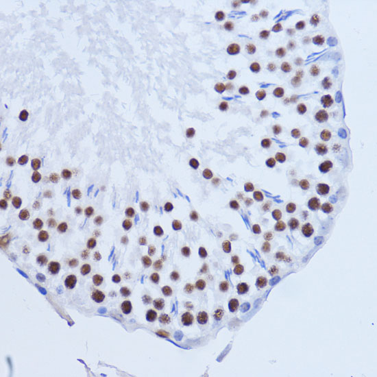 Anti-MATR3 Antibody (CAB5905)