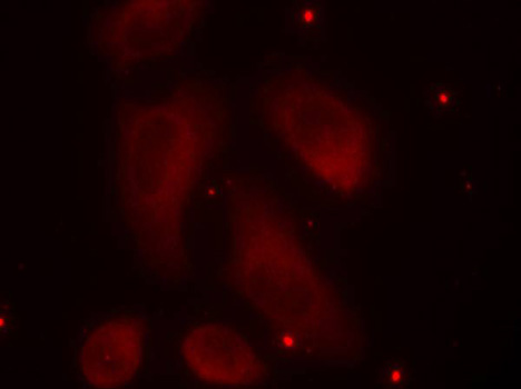 Anti-Phospho-LIM domain kinase 1-T508 Antibody (CABP0387)