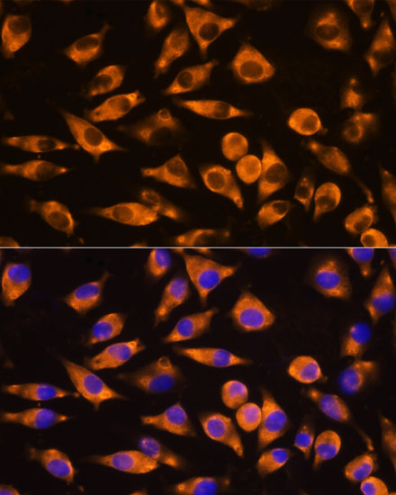 Anti-CEP55 Polyclonal Antibody (CAB8229)