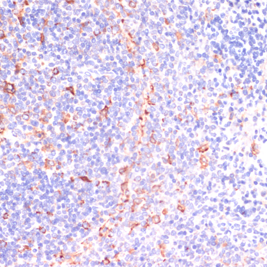 Anti-IKKEpsilon Antibody (CAB0244)