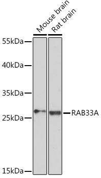 Anti-RAB33A Antibody (CAB17049)