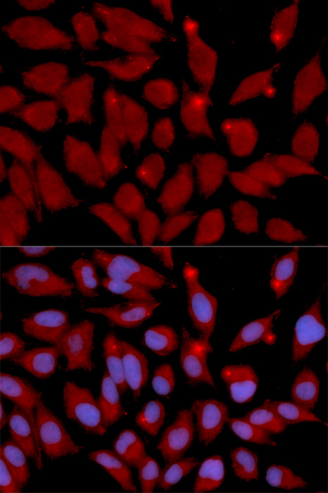 Anti-DNMT3A Antibody (CAB2065)